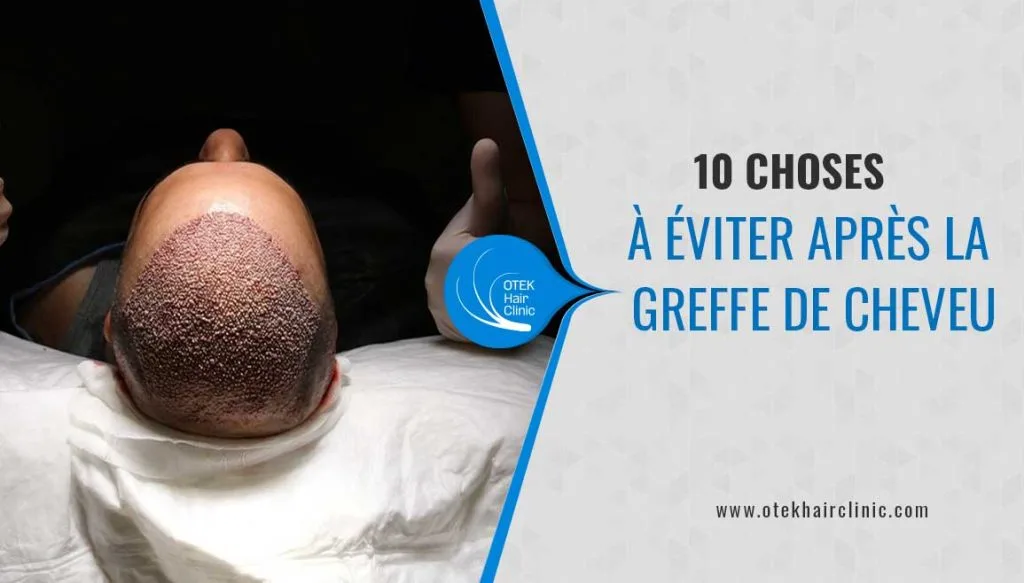 10 choses a eviter apres la greffe de cheveu