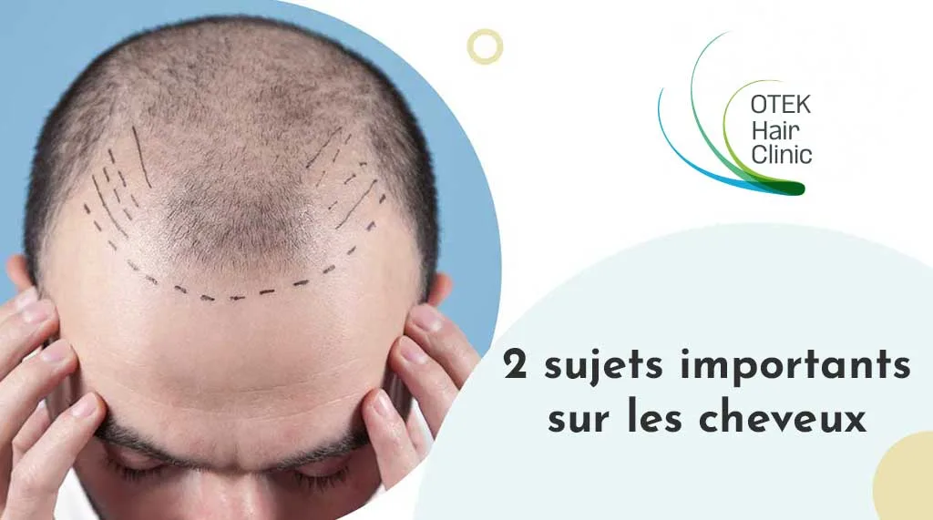 2 Sujets Importants Sur Les Cheveux 5 2 sujets importants sur les