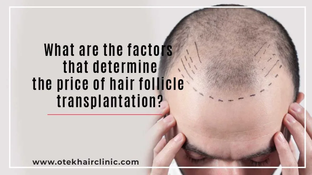 Quels Sont Les Facteurs Qui Déterminent le Prix de la Greffe de Cheveux ? 5 Blog Template