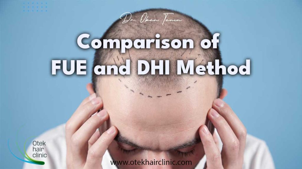 DHI Method - Otek Hair Clinic