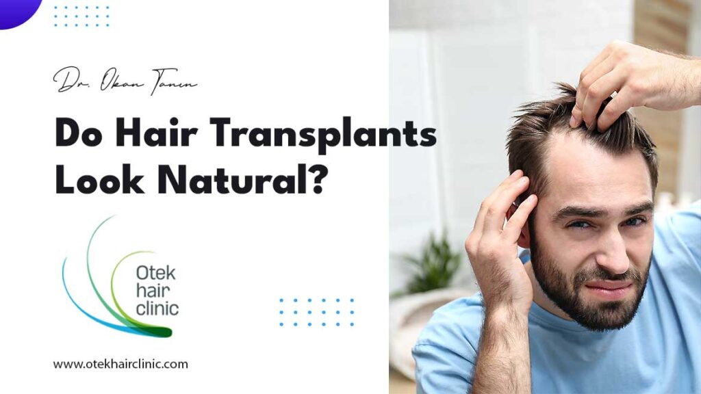 Do Hair Transplants Look Natural 1024x576 1