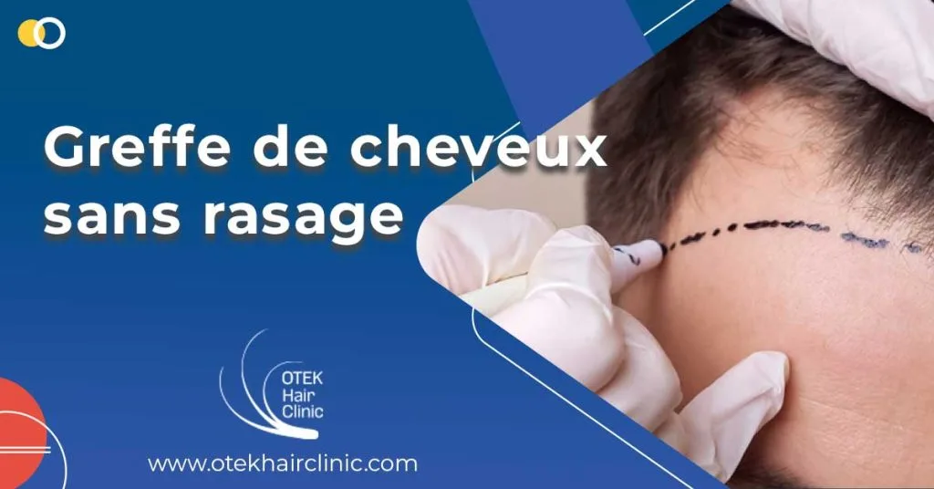 Greffe de cheveux sans rasage