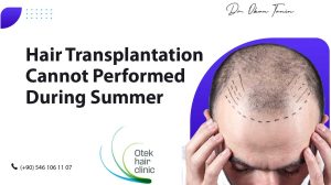 Hair Transplantation Cannot Performed During Summer