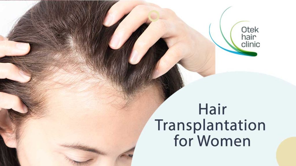 Hair Transplantation for Women