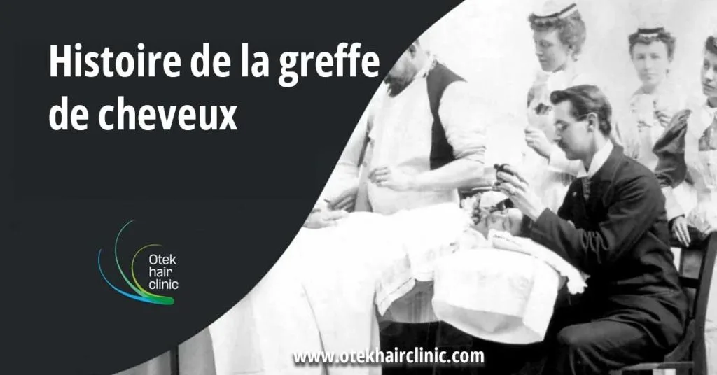 Histoire de la greffe de cheveux