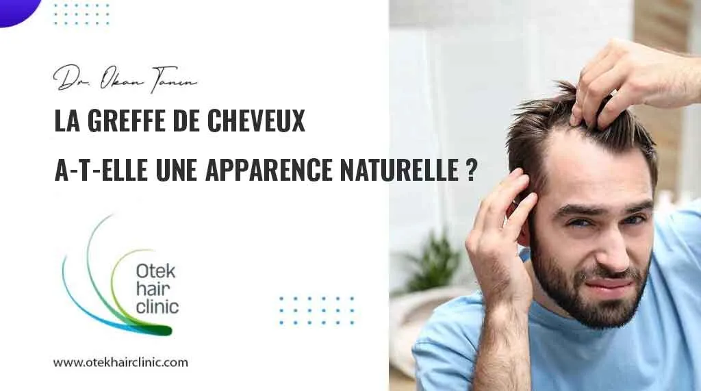 La greffe de cheveux a t elle une apparence naturelle