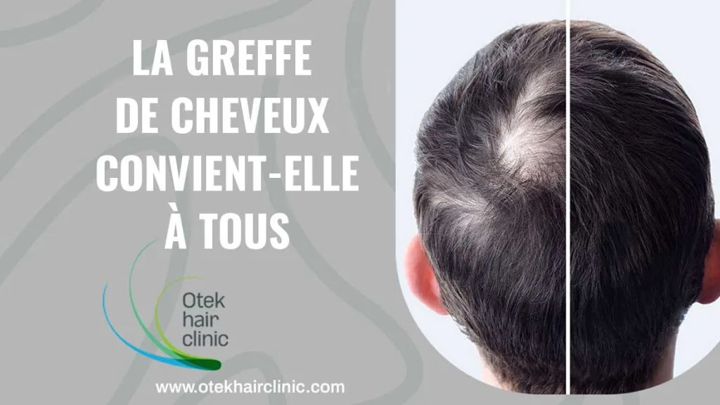 La greffe de cheveux convient elle a tous