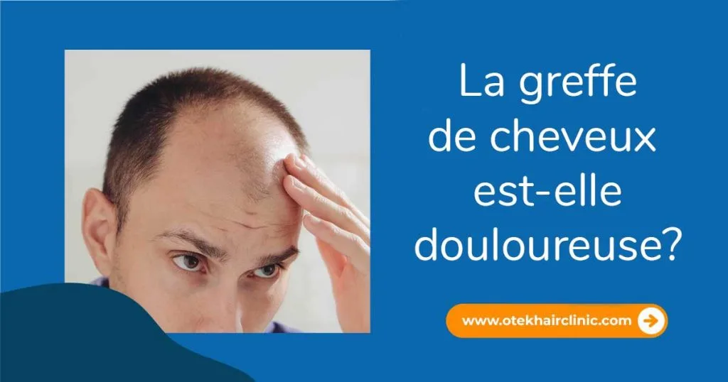 La greffe de cheveux est elle douloureuse
