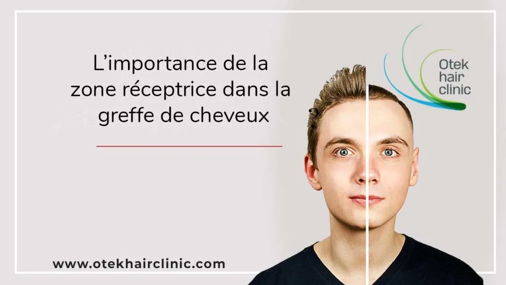 Limportance de la zone receptrice dans la greffe de cheveux