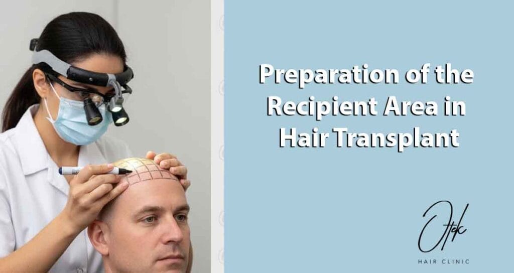 Preparation of the Recipient Area in Hair Transplant 1