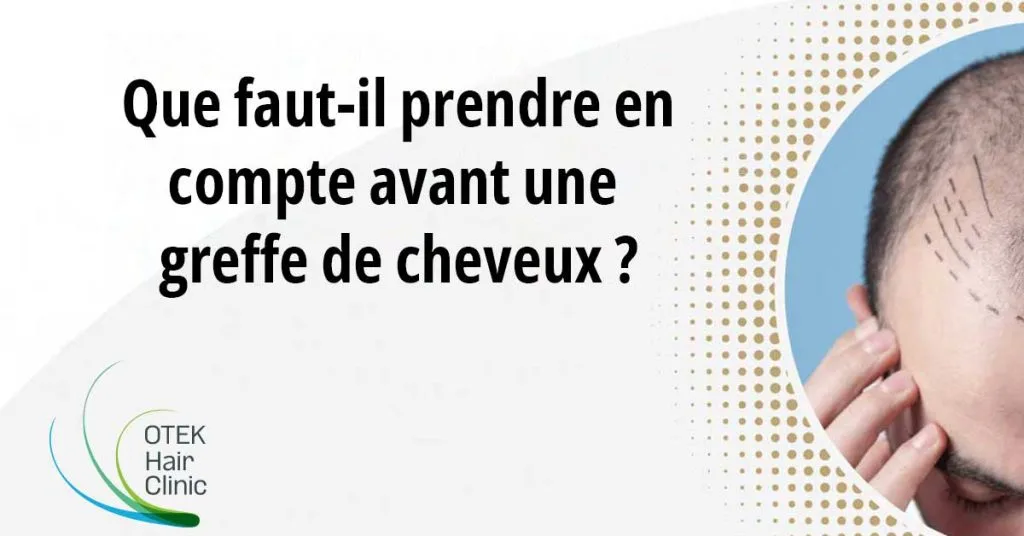 Que Faut-il Prendre en Compte Avant Une Greffe de Cheveux? 7 Que faut il prendre en compte avant une greffe de cheveux