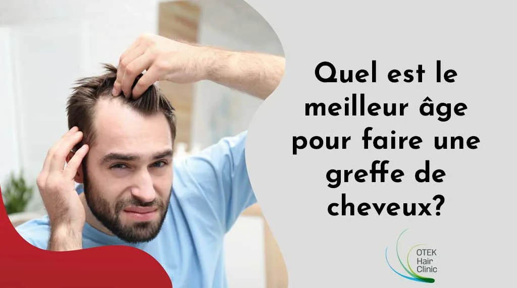 Quel Est le Meilleur Âge Pour Faire Une Greffe de Cheveux? 2 Quel est le meilleur age pour faire une greffe de