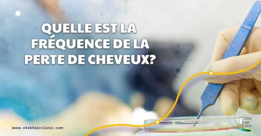 Quelle est la frequence de la perte de cheveux