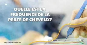 Blog-Fr 74 Quelle est la frequence de la perte de cheveux