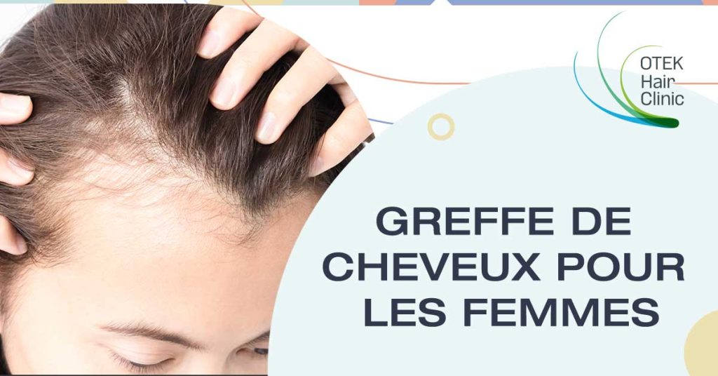 Quelles procedures de greffe de cheveux sont recommandees pour les femmes