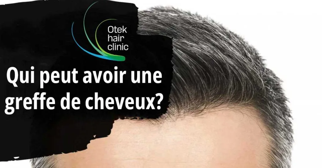 Qui Peut Avoir Une Greffe de Cheveux? 10 Qui peut avoir une greffe de cheveux