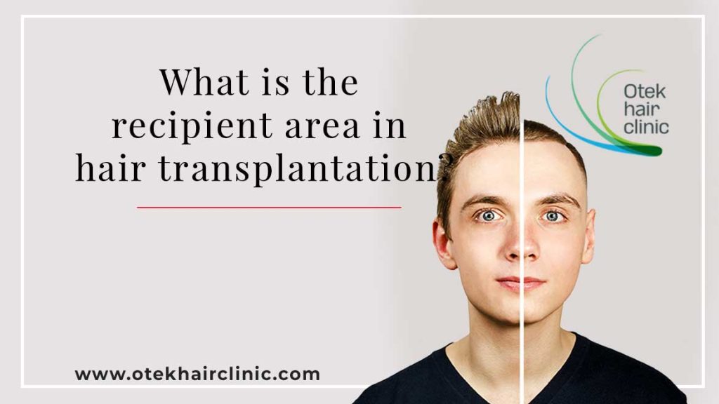 The importance of the recipient area in hair transplantation