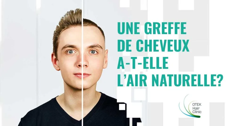 Une greffe de cheveux a t elle lair naturelle