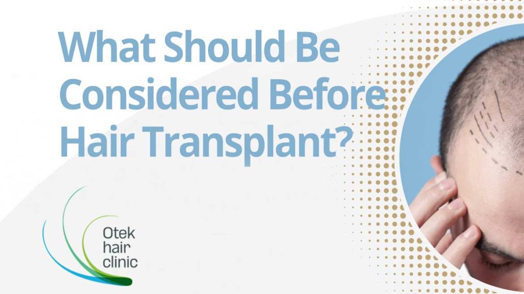 What Should Be Considered Before Hair Transplant