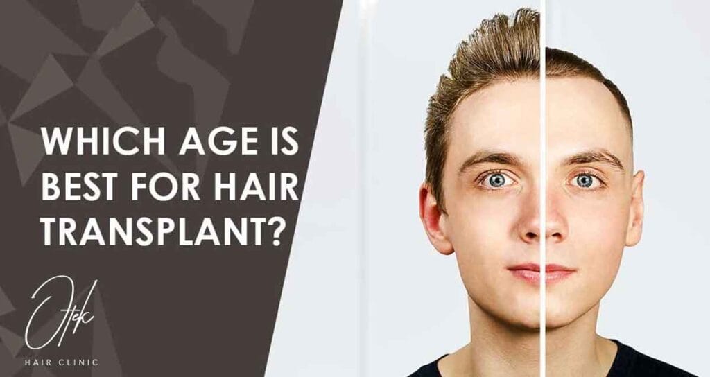 Which Age Is Best for Hair Transplant? 6 Which Age Is Best for Hair Transplant 1