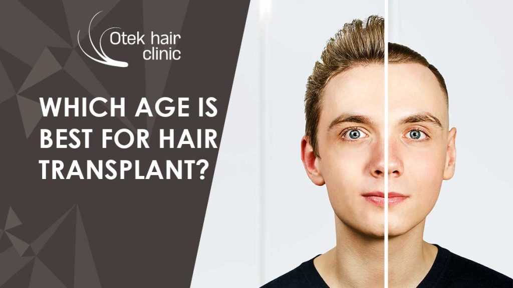 Which Age Is Best for Hair Transplant