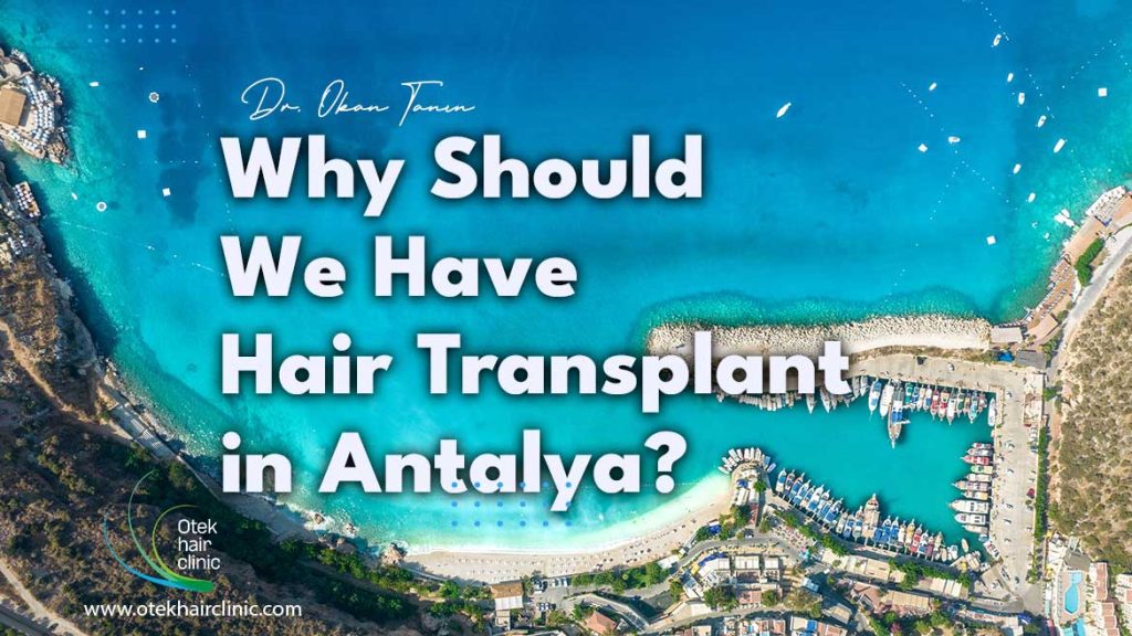 Why Should We Have Hair Transplant in Antalya 2