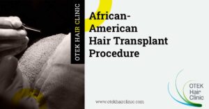 African-American Hair Transplant Procedure
