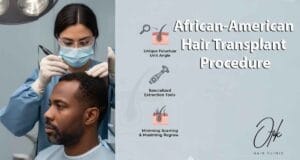 African American Hair Transplant Procedure 2
