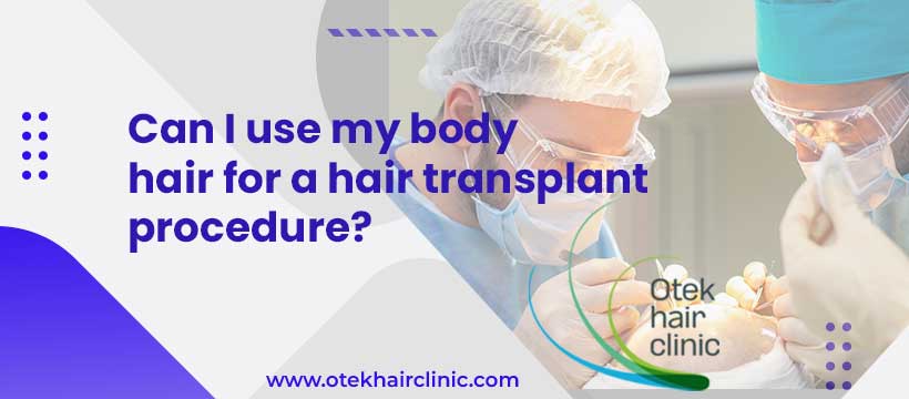 Can I use my body hair for a hair transplant procedure