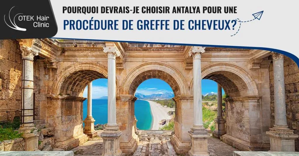 Pourquoi Devrais-je Choisir Antalya Pour une Procédure de Greffe de Cheveux?