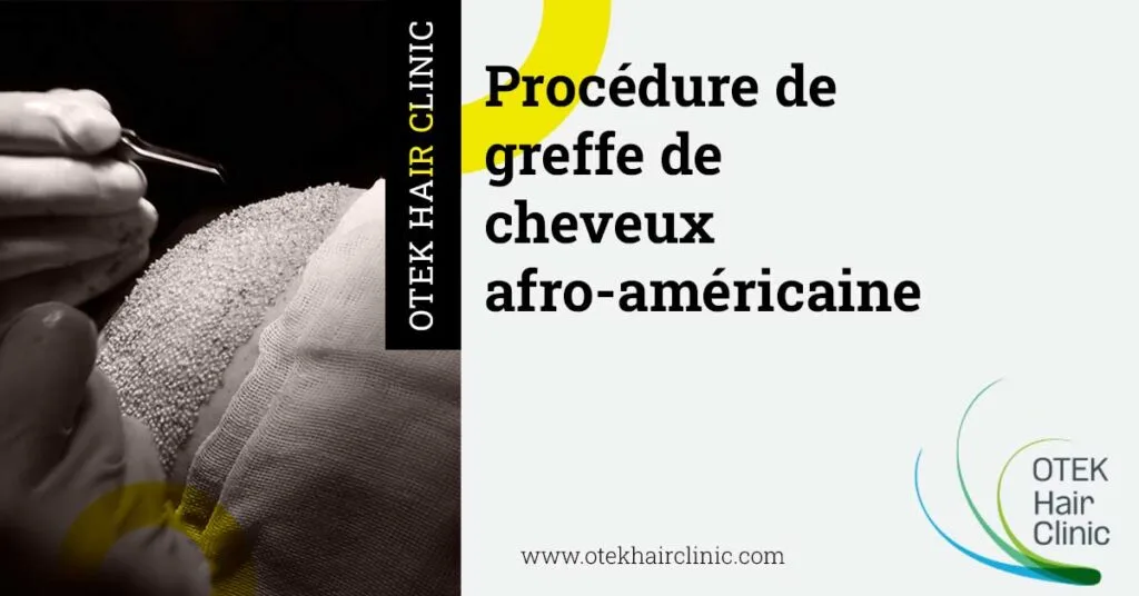 Procédure de greffe de cheveux afro-américaine