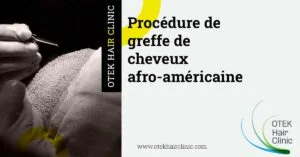 Blog-Fr 67 Procédure de greffe de cheveux afro-américaine