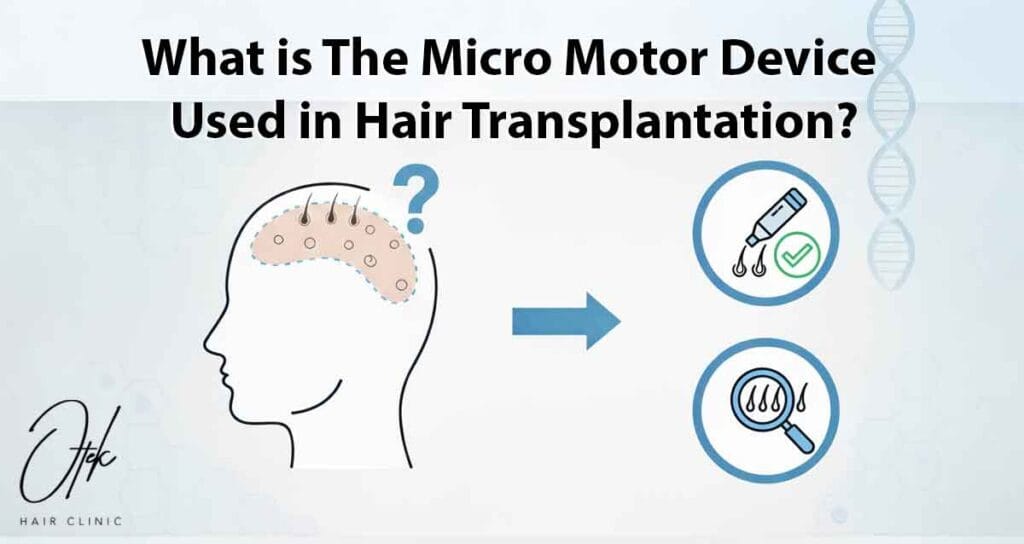 What is The Micro Motor Device Used in Hair Transplantation 2