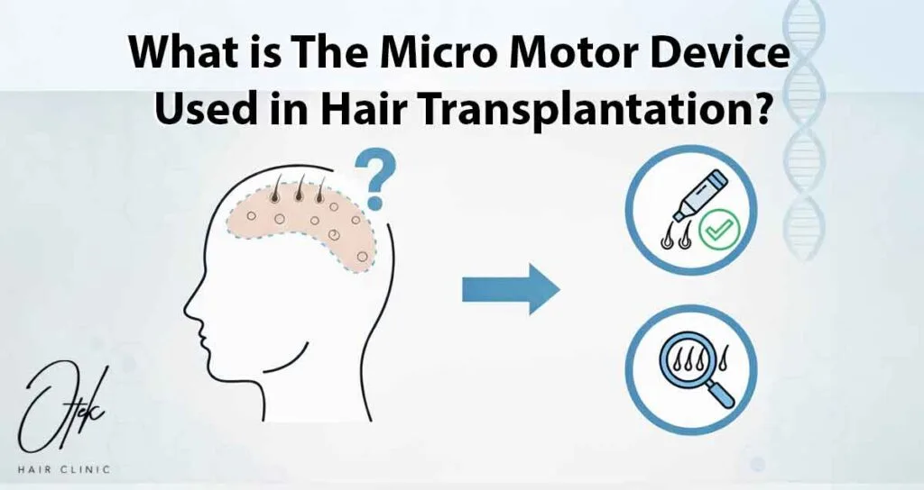 What is The Micro Motor Device Used in Hair Transplantation 2