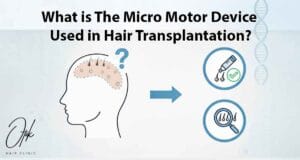 What is The Micro Motor Device Used in Hair Transplantation 2