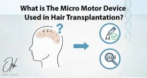 What is The Micro Motor Device Used in Hair Transplantation 2