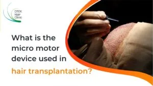 Blog-Fr 68 Quel est l’appareil micromoteur utilisé dans la greffe de cheveux ?