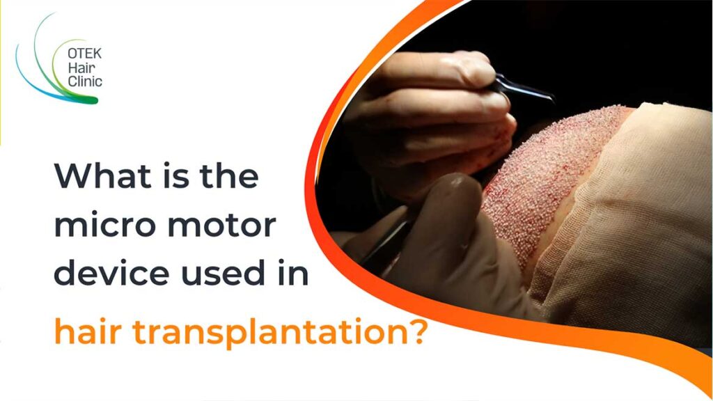 What-is-the-micro-motor-device-used-in-hair-transplantation