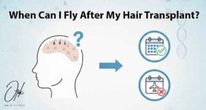 When Can I Fly After My Hair Transplant 1