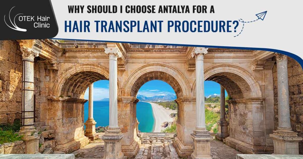 Why Should I Choose Antalya for a Hair Transplant Procedure