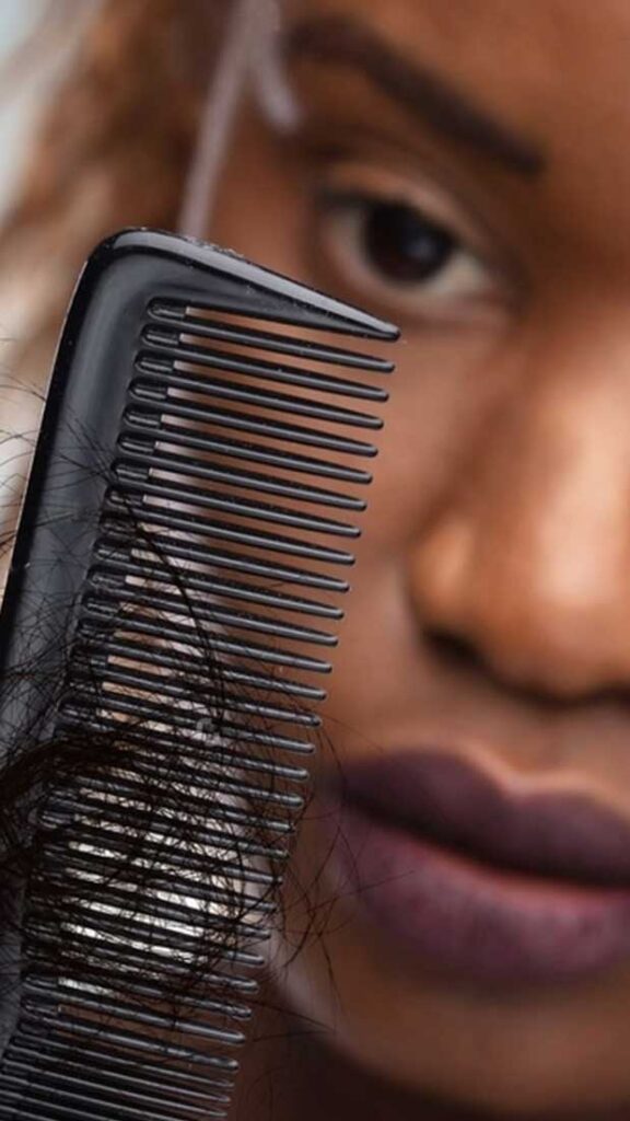 afro american hair transplant OTEK hair clinic