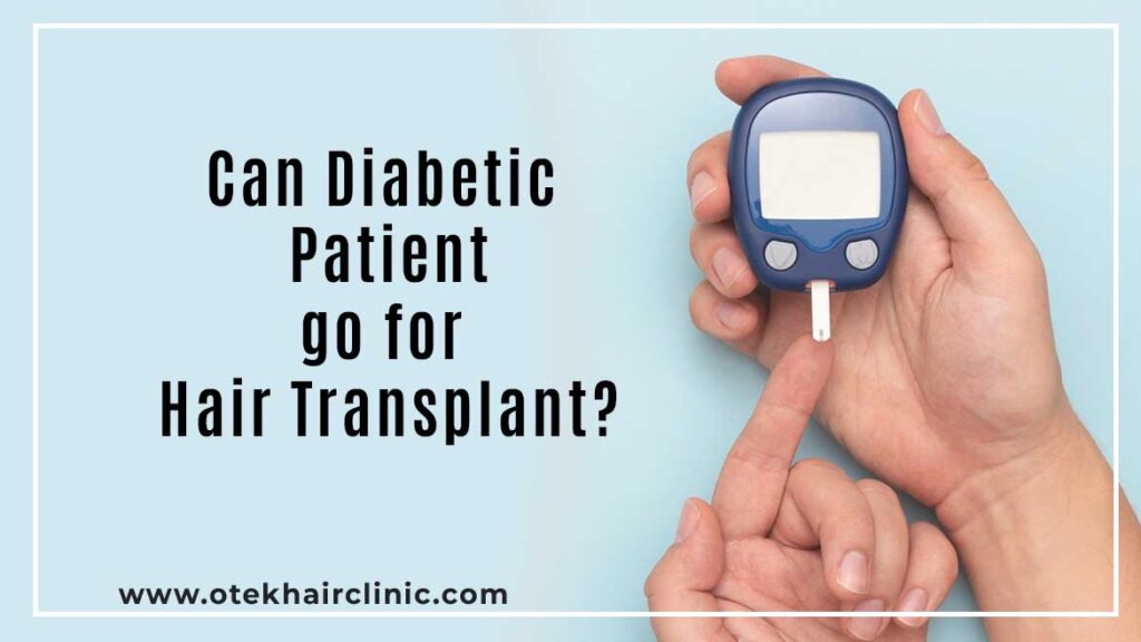 Can Diabetic Patient go for Hair Transplant?