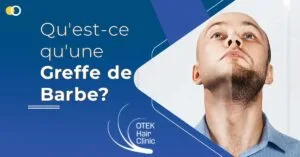 Blog-Fr 64 Qu'est-ce qu'une Greffe de Barbe
