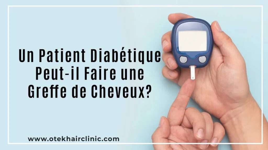 Un Patient Diabétique Peut-il Faire une Greffe de Cheveux?