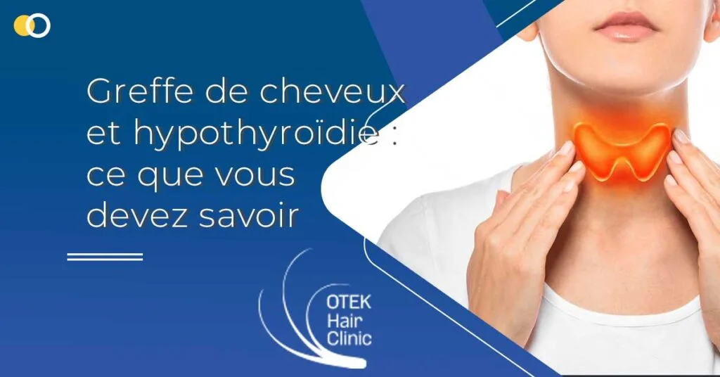 Greffe de Cheveux et Hypothyroïdie : Ce Que Vous Devez Savoir 2 Greffe de cheveux et hypothyroïdie : ce que vous devez savoir