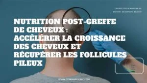 Blog-Fr 59 Nutrition post-greffe de cheveux : accélérer la croissance des cheveux et récupérer les follicules pileux