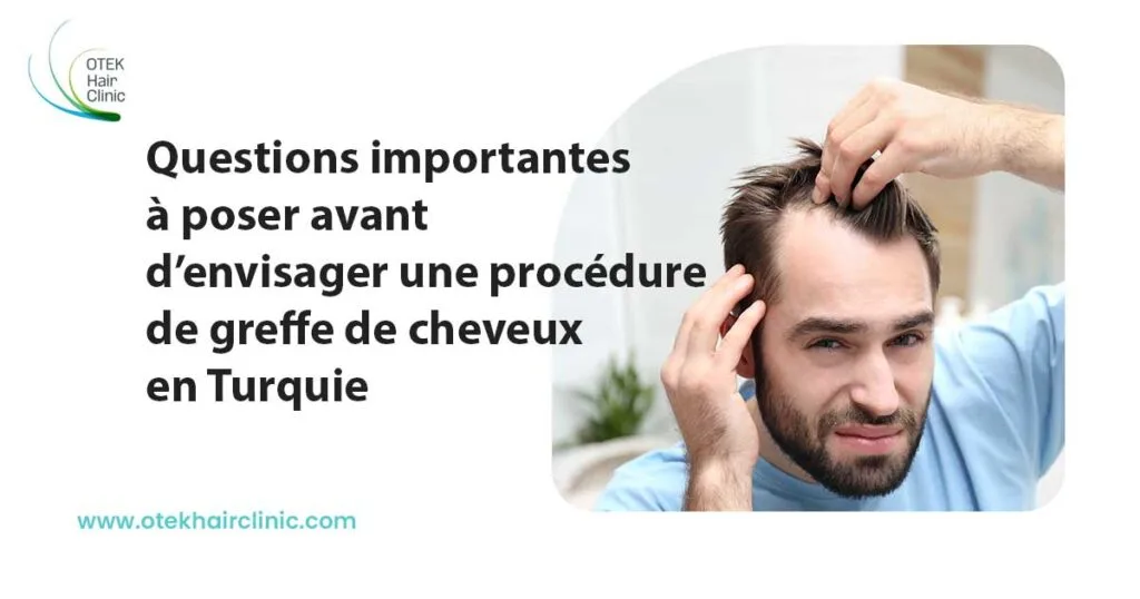 Questions Importantes à Poser Avant d'Envisager Une Procédure de Greffe de Cheveux en Turquie 2 Questions importantes à poser avant d’envisager une procédure de greffe de cheveux en Turquie
