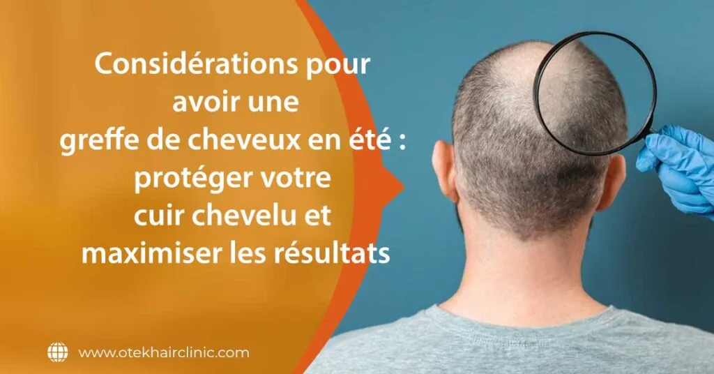 Considerations pour avoir une greffe de cheveux en ete proteger votre cuir chevelu et maximiser les resultats