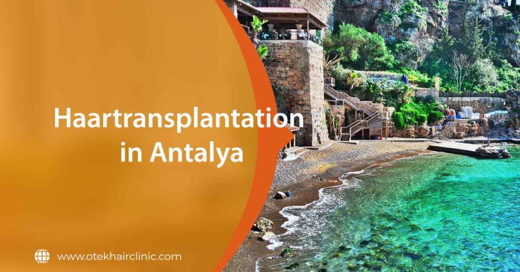 Haartransplantation in Antalya