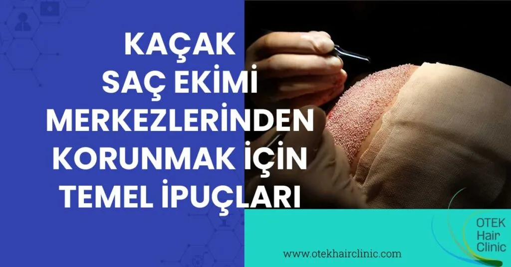 Kaçak Saç Ekimi Merkezlerinden Korunmak İçin Temel İpuçları